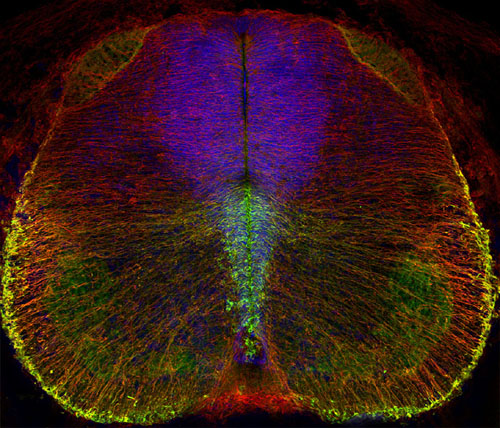 2- Embryonic Spinal Cord-sma