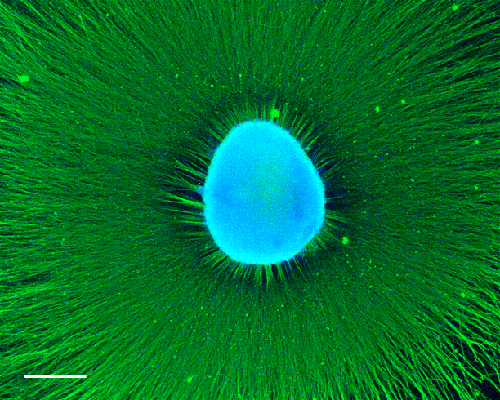 Neurosphere-sma