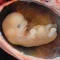 Human_Embryo_-_Approximately_8_weeks_estimated_gestational_age