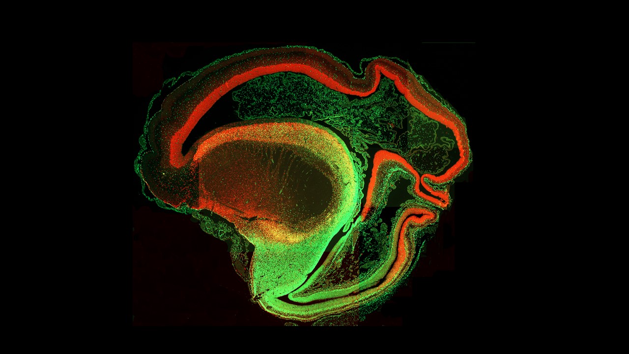 Cerebral cortex Cerebral cortex