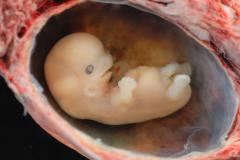 Human_Embryo_-_Approximately_8_weeks_estimated_gestational_age
