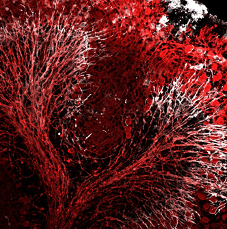 Cerebellar slice culture