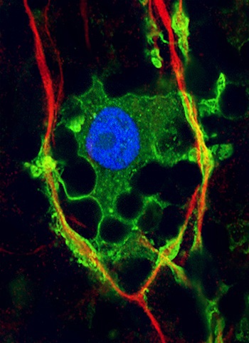 Oligodendrocyte