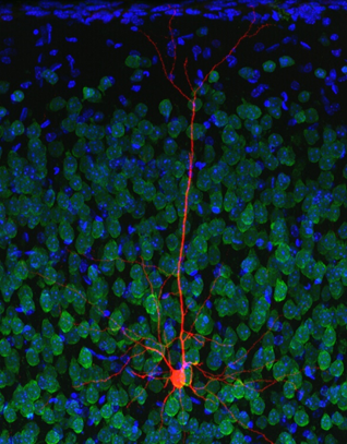 Lonely Cortical Neuron